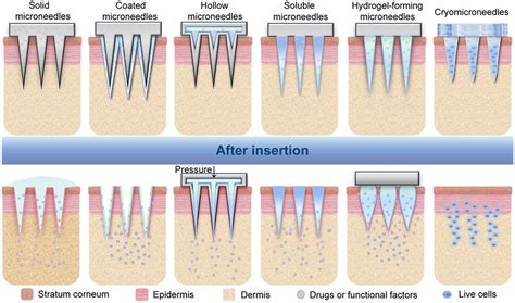 Microneedle System For Tissue Engineering And Regenerative Medicine