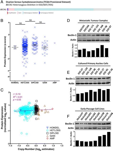 Beclin 1 Protein Expression Is Maintained In High Grade Serous Ovarian