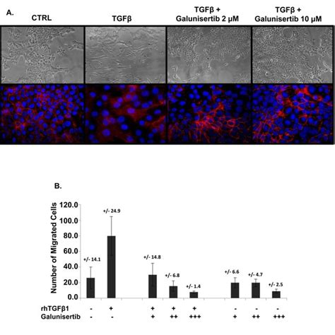 Galunisertib Inhibits Tgf Mediated Emt And Migration In Vitro A