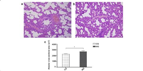 Histological Structure Of Lung A Histological Structure Of Lung In Download Scientific