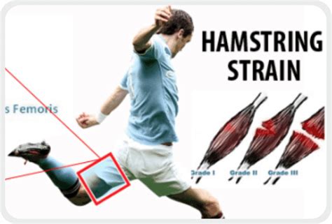 Effective Treatments For Healing Hamstring Strains Aktiv Health