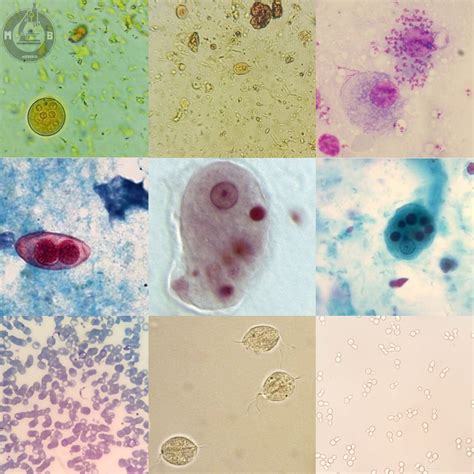 Entamoeba Coli Trofozoito