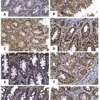 Immunohistochemical analysis of NF κB in gastric tissue of A control