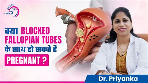 Fallopian Tubes में रुकावट के बाद Pregnant कैसे हों Fallopian Tubes Blockage Prime Ivf