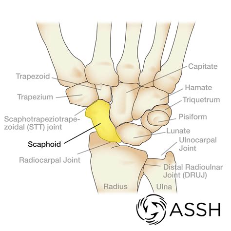 Body Anatomy: Upper Extremity Bones | The Hand Society