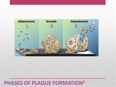 Dental plaque | PPT