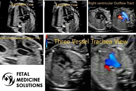 Fetal Echocardiography | Dr. Neha Gupta In Greater Noida