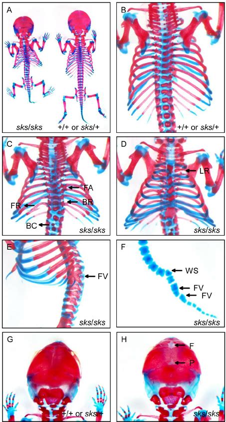 Skeletal Defects Of Sks Mutant Mice At The Neonatal Stage A Whole