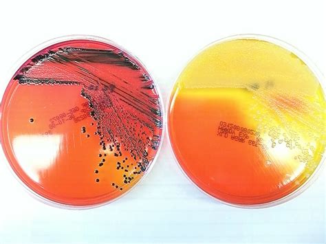 Xld Agar Result Comparison Explore Medical Microbiologys Flickr