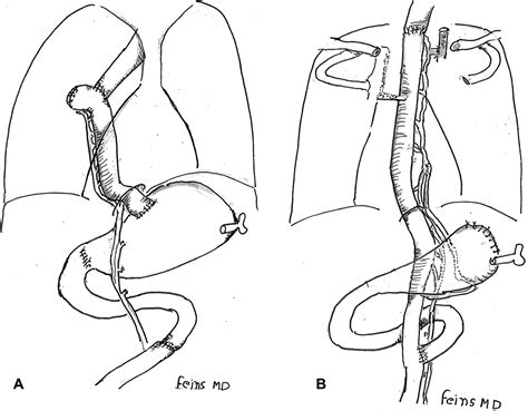 Journal Of The American College Of Surgeons