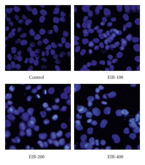 Eib Inhibited The Growth Of Smmc 7721 Cells A Cell Viability Of Download Scientific Diagram