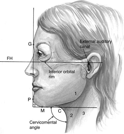 Liposuction Of The Face And Neck Operative Techniques In