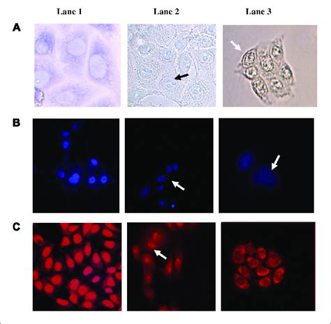 Morphological Changes Induced In HCT 15 Following 24 H Treatment With