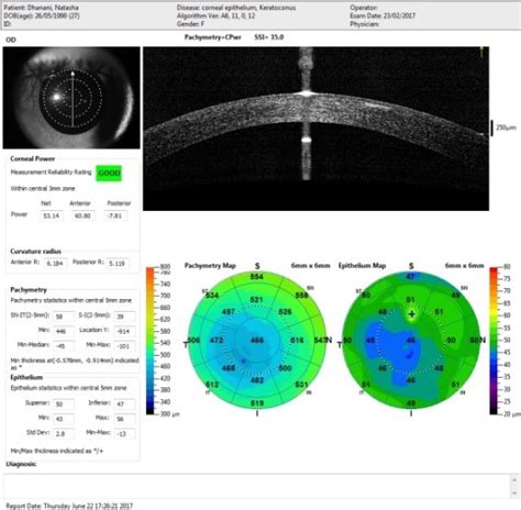 Keratoconus Laser Eye Centre Ltd