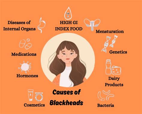 Blackhead removal: causes, symptoms and treatment