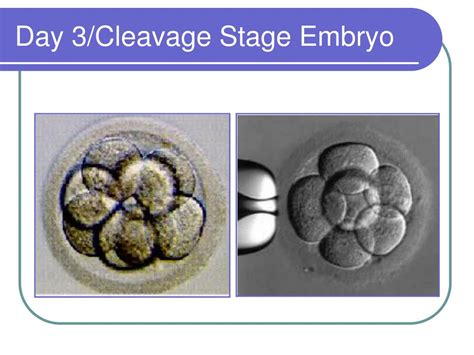 Ppt Preimplantation Genetic Diagnosis Pgd Powerpoint Presentation