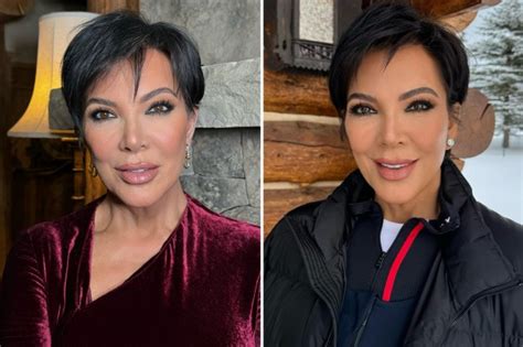 Kris Jenner Fans Suspect Reality Star Had A Secret Nose Job After