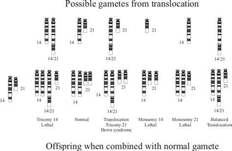 What Is The Difference Between Normal And Abnormal Karyotype Pediaacom