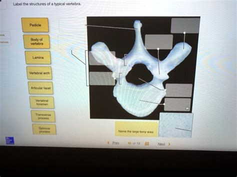 Solved Label The Structures Of A Typical Vertebra Pedicle Body Of