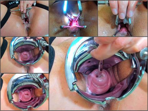 Amateur Porn Andradahot Medical Inspection Inside My Cervix Closeup