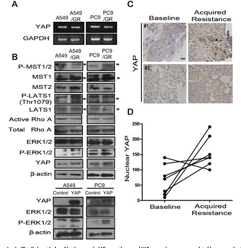 Figure 2 From Hippo Pathway Effector YAP Inhibition Restores The