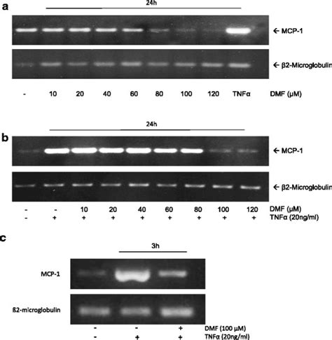 Analysis of constitutive and TNF α induced MCP 1 mRNA expression during