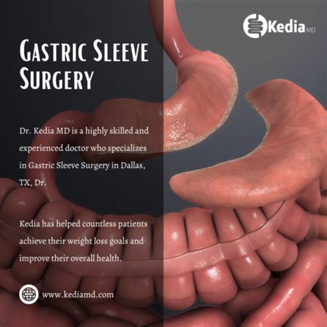 Top 10 Health Benefits Of Having Gastric Sleeve Surgery Dallas Tx