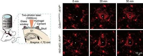 Cientistas Descobrem O Papel Da Hexoquinase Na Atividade Microglial