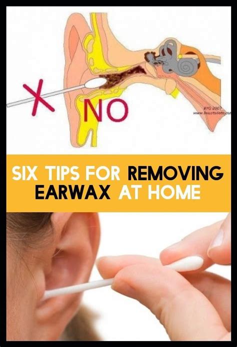 Six Tips For Removing Earwax At Home Ear Wax Natural Lubricant How To Remove