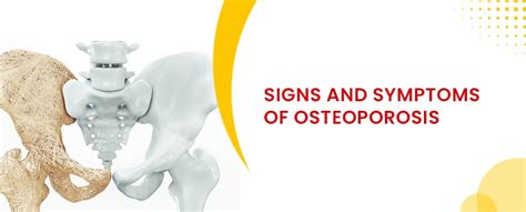 Signs And Symptoms Of Osteoporosis Bone Weakness Germanten Hospital