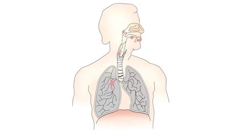 Metastasen Symptome Ursachen Und Behandlung Alpine Biomedical