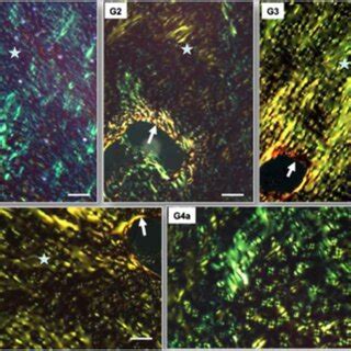 Three Dimensional Organization Of The Collagen Fibers In Articular