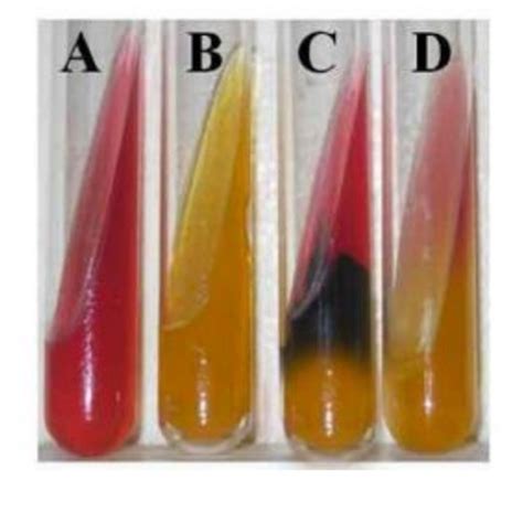 Triple Sugar Iron Agar Flashcards Quizlet