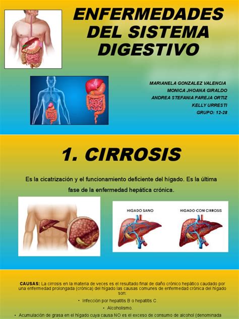 Enfermedades Del Sistema Digestivo Pdf La Enfermedad Por Reflujo