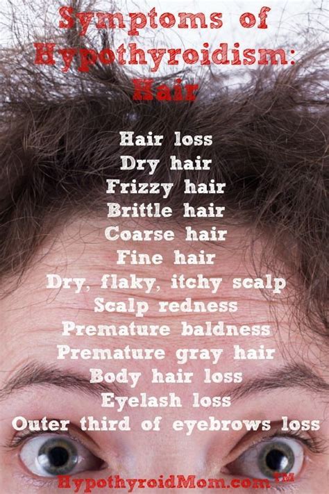 Natural hair loss treatment options – Artofit