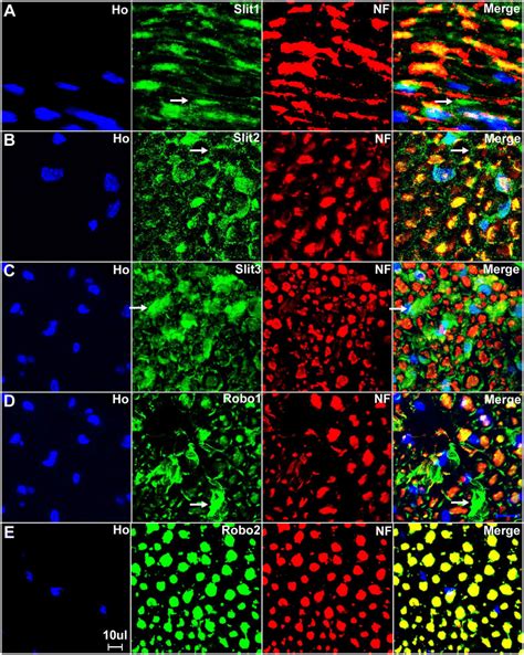 Higher Magnification Images From Fig 10 Show Slit1 3 And Robo1 2