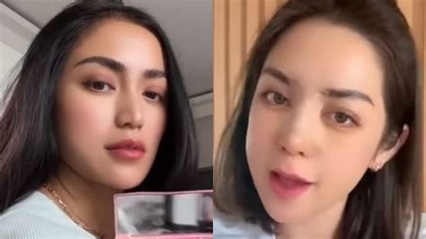 Bandingkan Wajah Jessica Iskandar Sebelum Dan Setelah Oplas Warganet