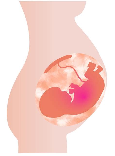 前置胎盤になりやすい人の特徴 新型出生前診断（nipt）− Dnaサイエンス