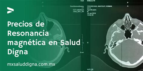 Precios De Resonancia Magn Tica En Salud Digna Salud Digna