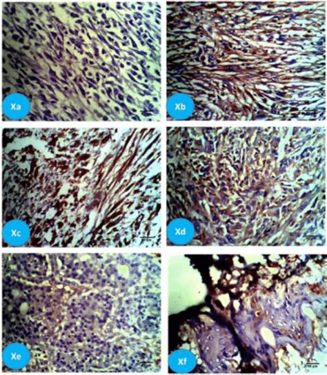 Representative Light Photomicrographs Of The Immunoreactivity Of Breast