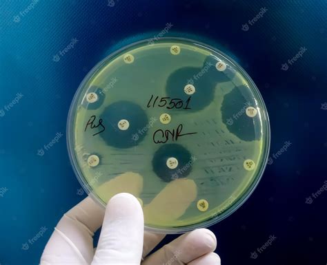 Premium Photo Hand Holding Culture Plate Of Bacterial Growth Showing Antibiotic Sensitivity In