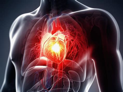 Coronary Microvascular Disease - Interventional Cardiology - DoctorHelps