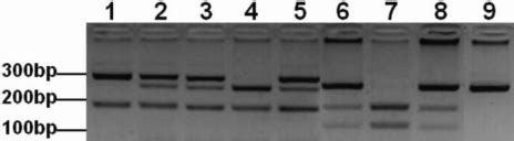 Agarose Gel Electrophoresis Of The Polymerase Chain Reaction Based