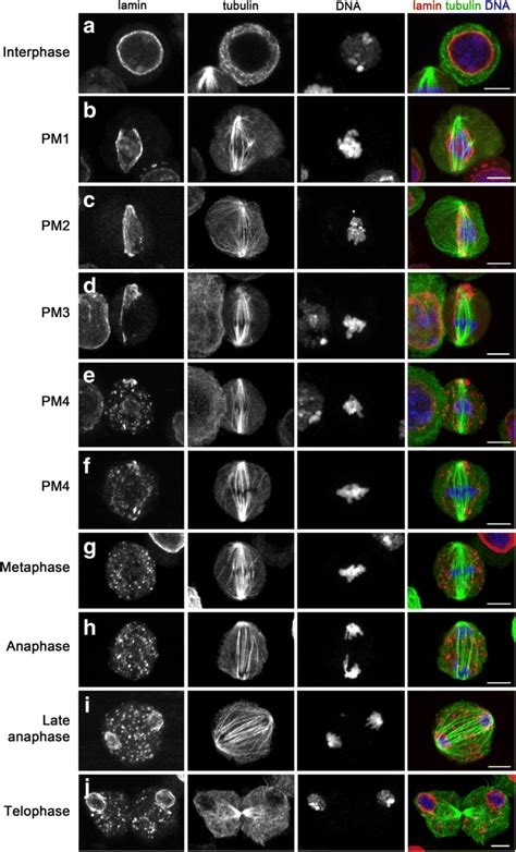 Lamin Immunostaining Recapitulates Tem Observations Cells Were Stained