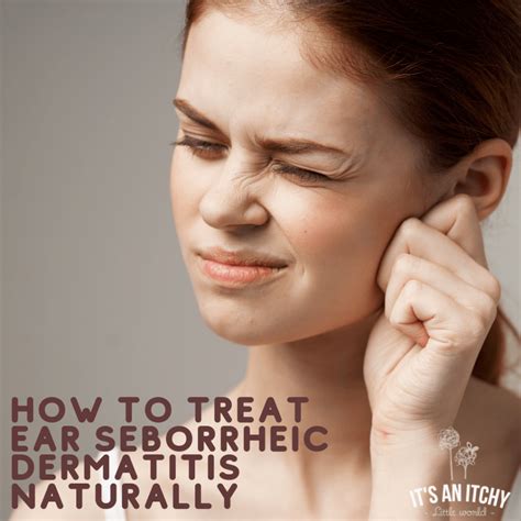 Natural Treatments For Ear Seborrheic Dermatitis