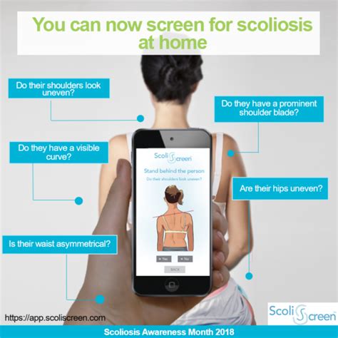 Online Scoliosis Screening Dr J Hartley