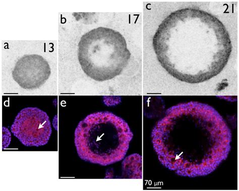 Direct Comparison Between Live Oct Images And Stained Two Photon