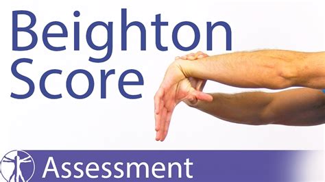 The Beighton Score Generalized Joint Hypermobility Laxity Youtube