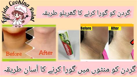 Neck Whitening Cream At Home Get Rid Of Dark Neck In Minutes