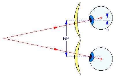 Dicoptic le dictionnaire de l optique Asphérique Verre Asphérique